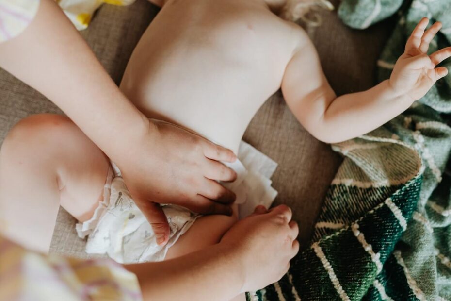 Ruam Popok Bayi Membandel, Ini Cara Ampuh Mengatasinya